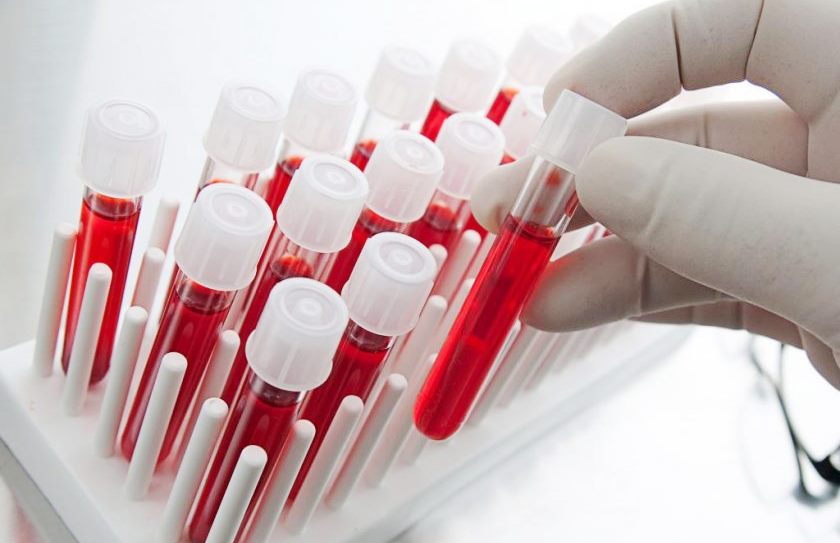 Как повысить тромбоциты в крови?